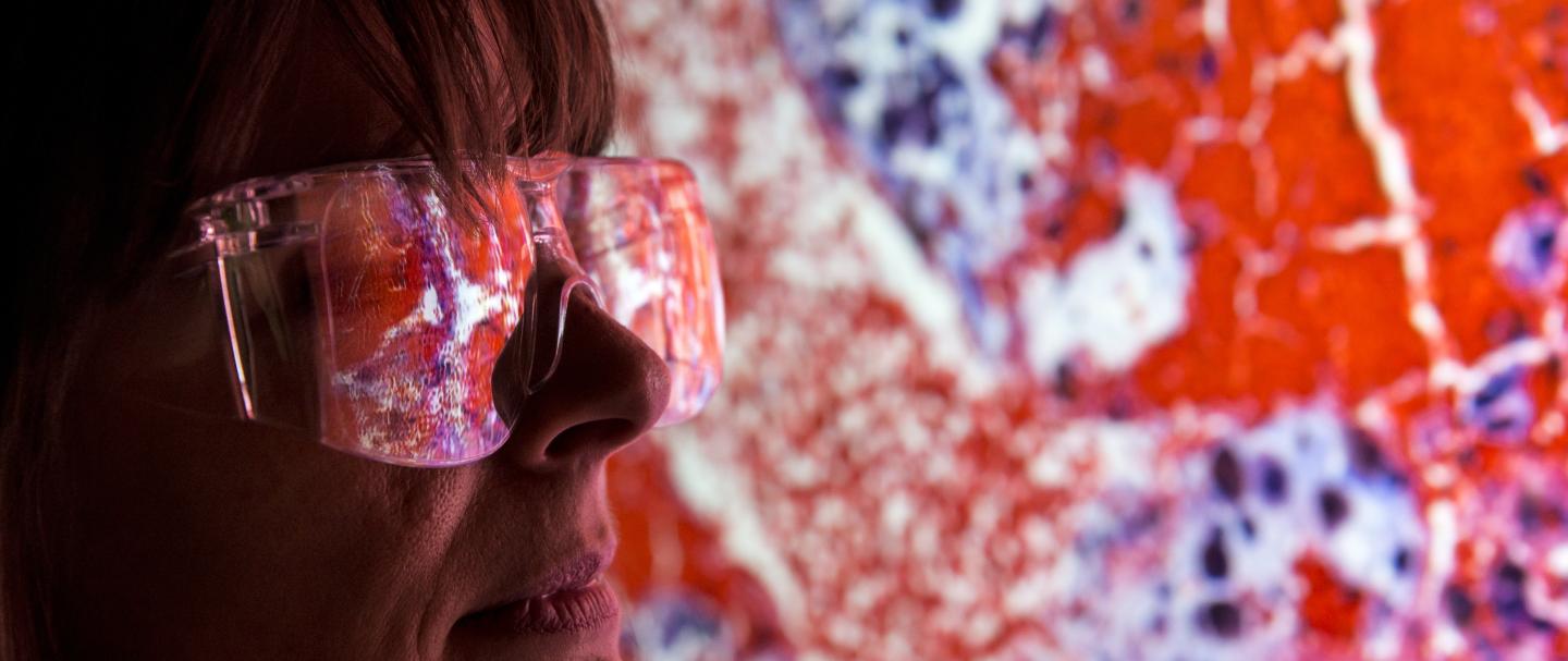 A woman wearing safety glasses reviewing medical imaging with areas of red and blue